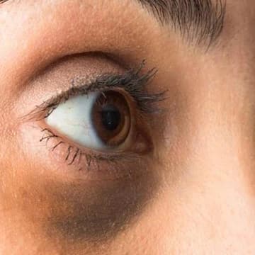 ANTI DARK CIRCLE/ANTI DARK SPOTS