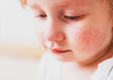 In-vitro Carcinogenicity