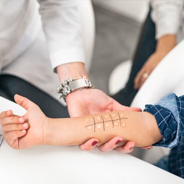Skin Sensitization (h-CLAT)