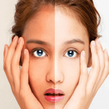skin penetration
